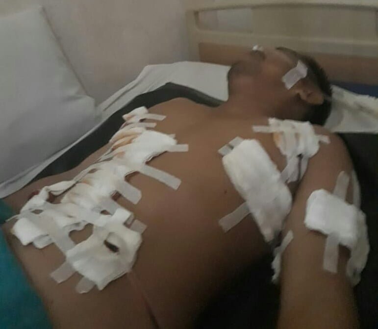Suryadi korban 7 kali penusukan di pulau pandan. Foto: Yogi/Jambiseru.com