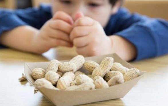 Tips untuk Orang Tua dari Anak Alergi Kacang Tanah