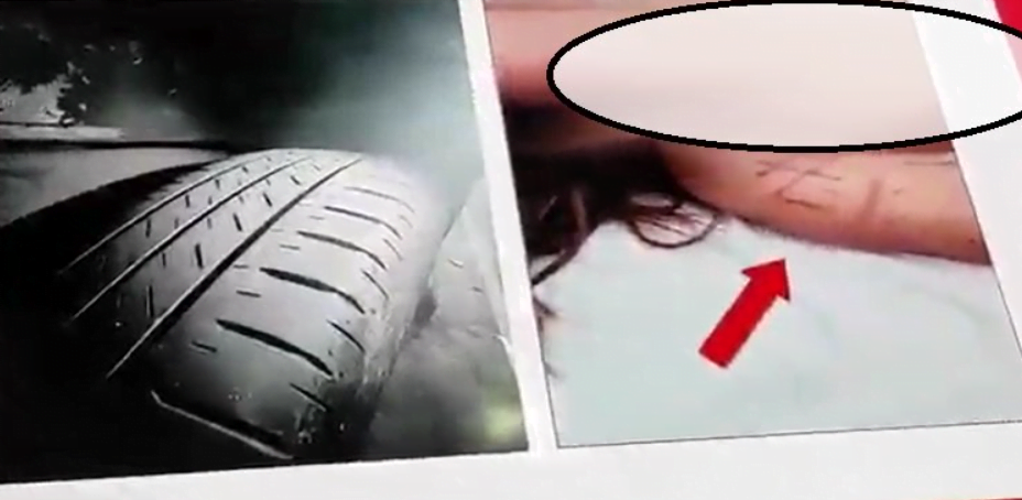 polisi mengungkap kasus penganiayaan maut di surabaya, jawa timur yang melibatkan anak anggota dpr.