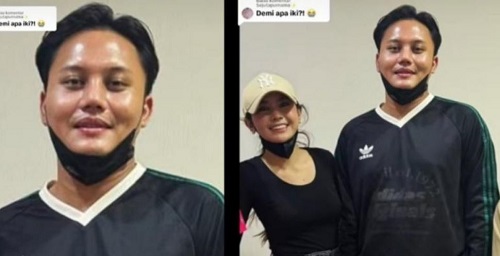 rizky febian operasi hidung netizen operasi sinus di dalam hidung bukan merubah bentuk