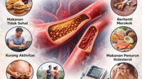 cara ampuh menurunkan kolesterol tanpa obat berlebihan