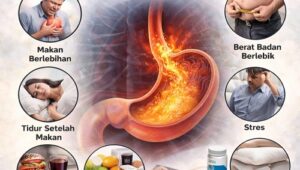 cara mengatasi asam lambung naik tanpa obat berlebihan