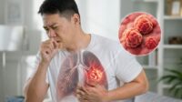 10 Tanda Awal Kanker Paru-Paru yang Wajib Diwaspadai Sejak Dini