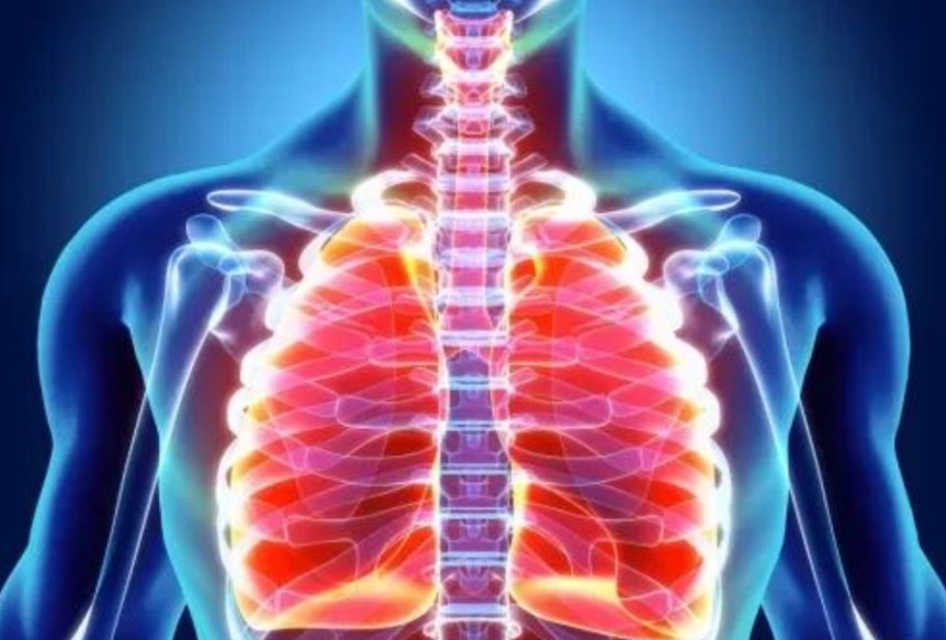 Ciri-Ciri Paru-Paru Tidak Sehat yang Sering Diabaikan, Waspada Sebelum Terlambat