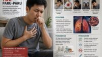 tbc paru paru gejala, penyebab, dan cara mengobati tuberkulosis secara tuntas