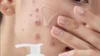 moisturizer untuk jerawat terbaik 2026 nggak bikin mampet, nggak perih, tenangin merah + resep jus tomat wortel anti inflamasi buat kulit calm