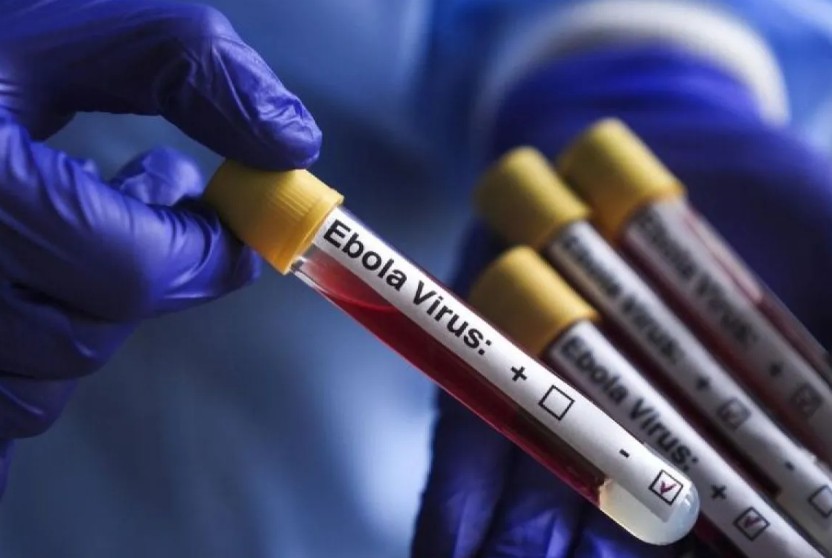Cegah Penularan, AS Lengkapi Bandara dengan Alat Uji Ebola Jelang Piala Dunia